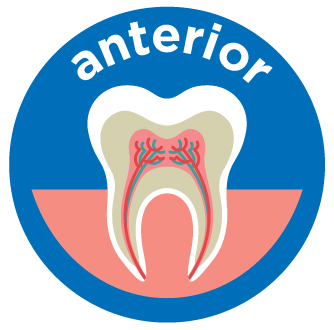 anterior root canal costs aspen dental